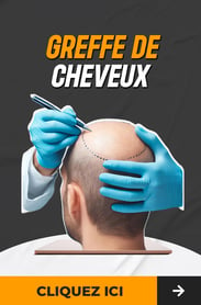 Greffe de cheveux en Turquie